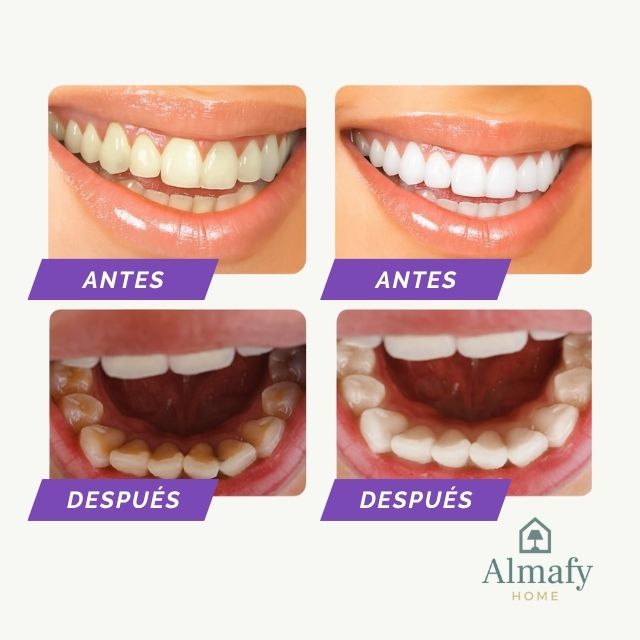 OBSESSIVE™ – Espuma Blanqueadora Dental