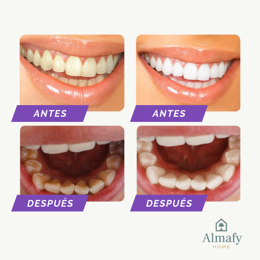 OBSESSIVE – Espuma Blanqueadora Dental