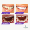 OBSESSIVE – Espuma Blanqueadora Dental
